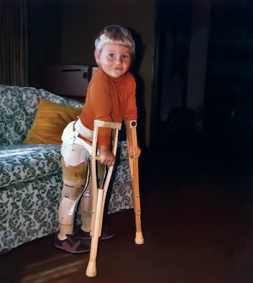 Matt as a child with wooden legs